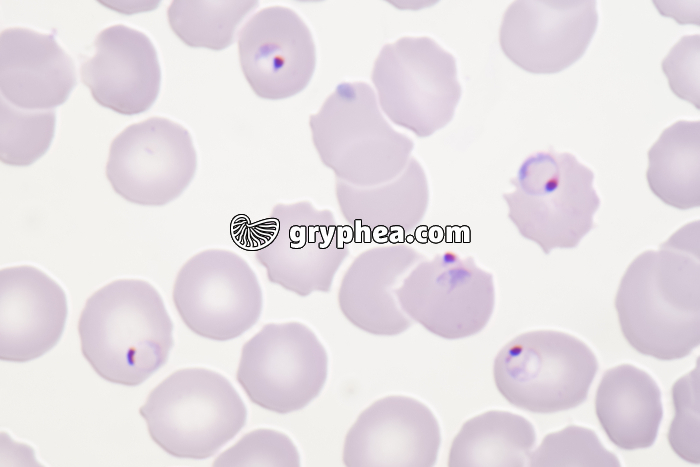 Plasmodium falciparum (forme évoluée) x800 - gryphea.org